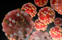 Measles