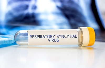 test tube labeled Respiratory Syncytial Virus