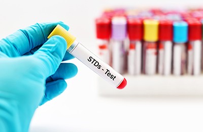 Sexually Transmitted Disease testing, gloved hand holding a STDs testing tube