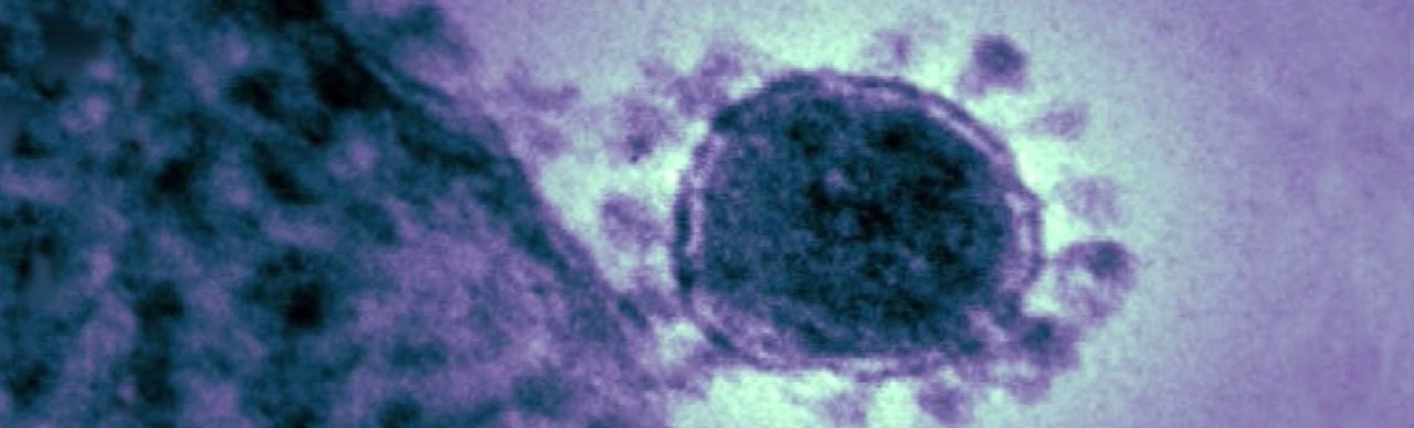 MERS cell