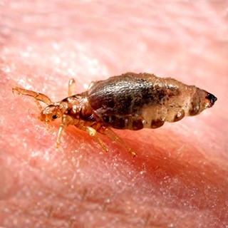 human body louse -320x320