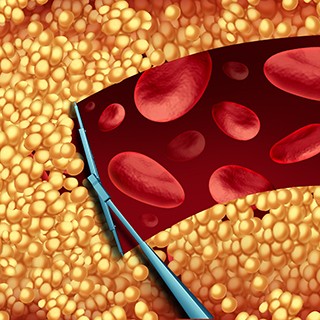 removing cholesterol from blood